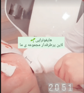 نمونه هایفوتراپی دکتر سحر مروج