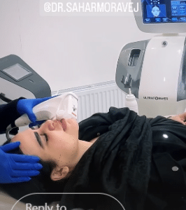 نمونه هایفوتراپی دکتر سحر مروج