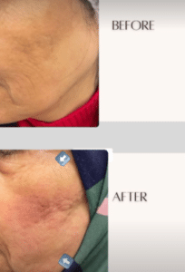 نمونه هایفوتراپی دکتر سحر مروج