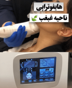 نمونه هایفوتراپی دکتر سحر مروج