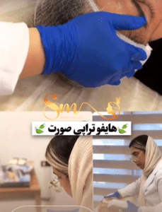 نمونه هایفوتراپی دکتر سحر مروج