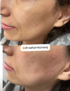 نمونه هایفوتراپی دکتر سحر مروج