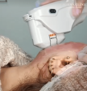 نمونه هایفوتراپی کلینیک زیبایی برنا