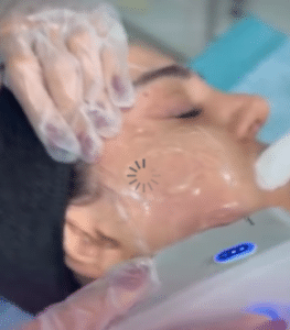 نمونه هایفوتراپی کلینیک زیبایی برنا