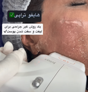 نمونه هایفوتراپی کلینیک زیبایی باران