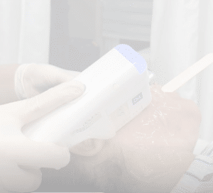 نمونه هایفوتراپی کلینیک زیبایی افسون