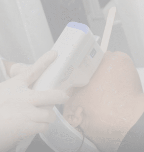 نمونه هایفوتراپی کلینیک زیبایی افسون