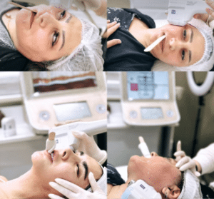 نمونه هایفوتراپی کلینیک زیبایی افسون