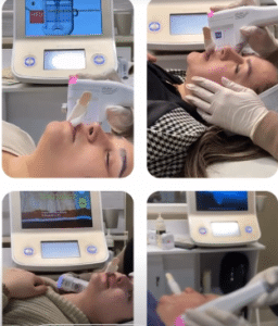 نمونه هایفوتراپی کلینیک زیبایی افسون