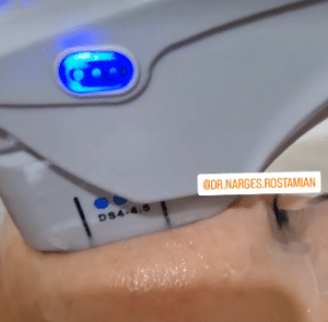 نمونه هایفوتراپی دکتر نرگس رستمیان