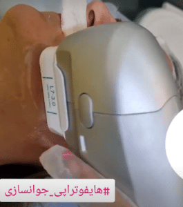 نمونه هایفوتراپی دکتر نرگس رستمیان