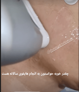 نمونه هایفوتراپی دکتر نرگس رستمیان