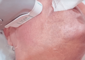 نمونه هایفوتراپی دکتر نرگس رستمیان