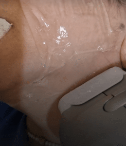 نمونه هایفوتراپی دکتر نرگس رستمیان