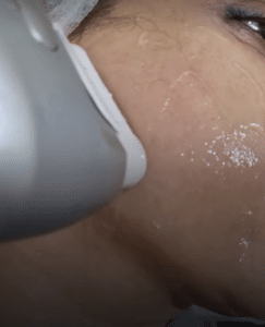 نمونه هایفوتراپی دکتر نرگس رستمیان