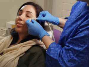 نمونه کربوکسی تراپی دکتر رجا قلیان