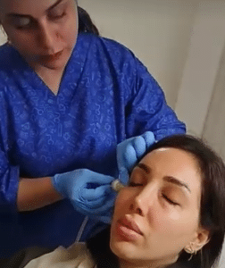 نمونه کربوکسی تراپی دکتر رجا قلیان