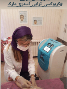 نمونه کربوکسی تراپی کلینیک زیبایی رزگلد