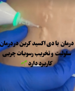 نمونه کربوکسی تراپی دکتر سجر مروج