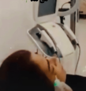 نمونه کربوکسی تراپی دکتر سجر مروج