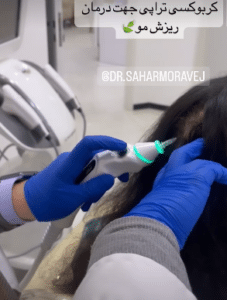 نمونه کربوکسی تراپی دکتر سجر مروج