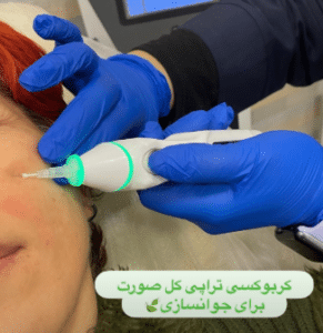 نمونه کربوکسی تراپی دکتر سجر مروج