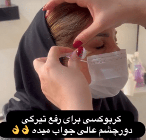 نمونه کربوکسی تراپی مرکز آرا پوست
