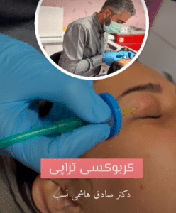 نمونه کربوکسی تراپی دکتر صادق هاشمی نسب