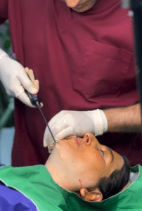 نمونه ساکشن غبغب دکتر قاسم رحمت پور رکنی