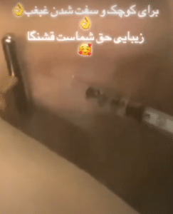 نمونه مزو غبغب مرکز آرا پوست ساریث