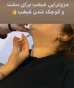 نمونه مزو غبغب مرکز آرا پوست ساریث