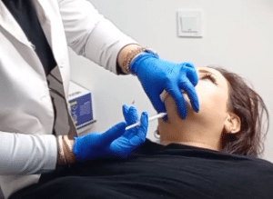 نمونه تزریق چربیسوز غبغب کلینیک زیبایی سام