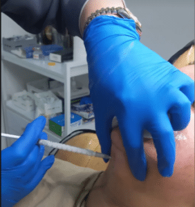 نمونه تزریق چربیسوز غبغب کلینیک زیبایی سام