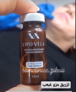 نمونه تزریق چربیسوز غبغب کلینیک زیبایی سام