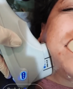 نمونه هایفو غبغب دکتر نرگس رستمیان