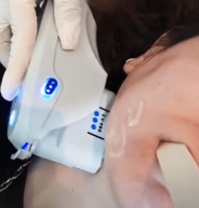 نمونه هایفو غبغب دکتر نرگس رستمیان