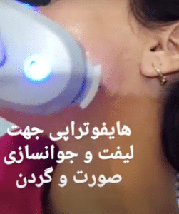 نمونه هایفو غبغب دکتر نرگس رستمیان