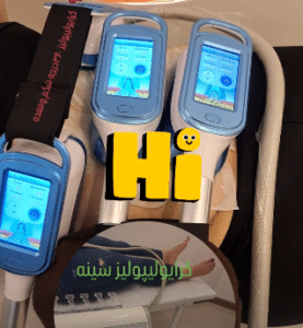 نمونه کرایولیپولیز لاغری کلینیک پردیسان