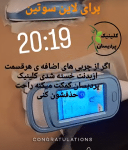 نمونه کرایولیپولیز لاغری کلینیک پردیسان