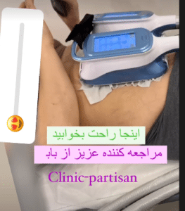 نمونه کرایولیپولیز لاغری کلینیک پردیسان