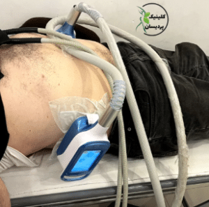 نمونه کرایولیپولیز لاغری کلینیک پردیسان