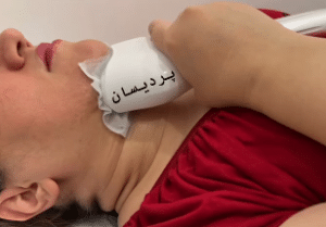 نمونه کرایولیپولیز لاغری کلینیک پردیسان