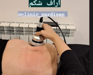 نمونه آر اف لاغری کلینیک پردیسان