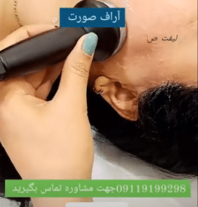 نمونه آر اف لاغری کلینیک پردیسان