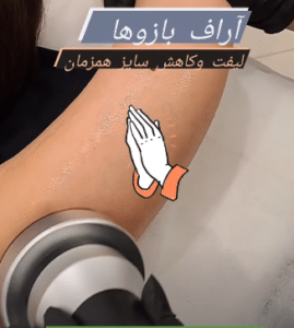 نمونه آر اف لاغری کلینیک پردیسان