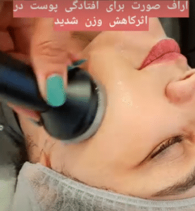 نمونه آر اف لاغری کلینیک پردیسان