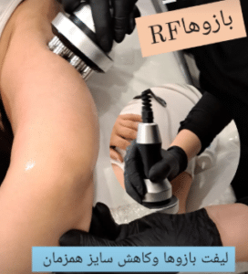 نمونه آر اف لاغری کلینیک پردیسان