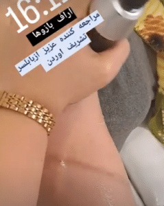 نمونه آر اف لاغری کلینیک پردیسان