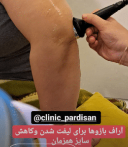 نمونه آر اف لاغری کلینیک پردیسان