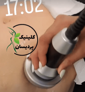 نمونه آر اف لاغری کلینیک پردیسان